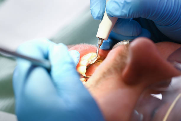 Best Emergency Treatment for Toothache in John Day, OR